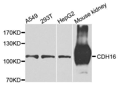 Anti-CDH16 Antibody