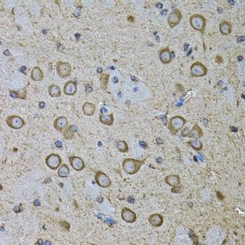 Anti-CDH16 Antibody