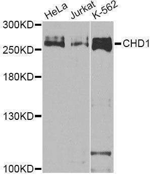 Anti-CHD1 Antibody