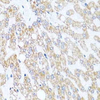 Anti-CHD1 Antibody