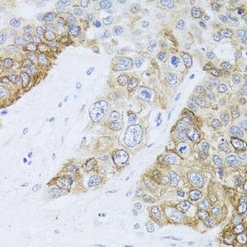 Anti-CHD1 Antibody