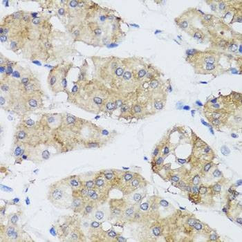 Anti-FGF13 Antibody