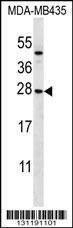 Anti-KLRC1 (N-term) Antibody