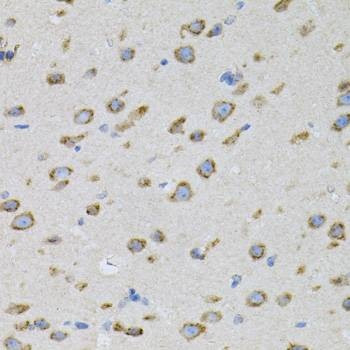 Anti-NAPA Antibody