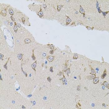 Anti-NAPA Antibody