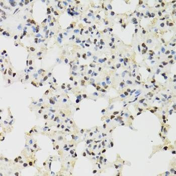 Anti-KDM4A Antibody