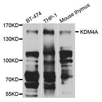 Anti-KDM4A Antibody