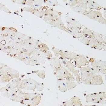Anti-KDM4A Antibody