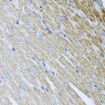 Anti-MTX2 Antibody