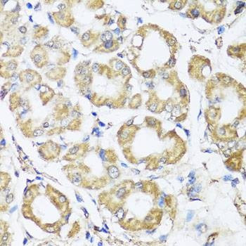 Anti-B9D1 Antibody