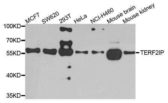 Anti-TERF2IP Antibody