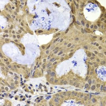 Anti-TERF2IP Antibody