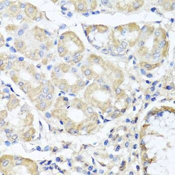 Anti-OPA3 Antibody