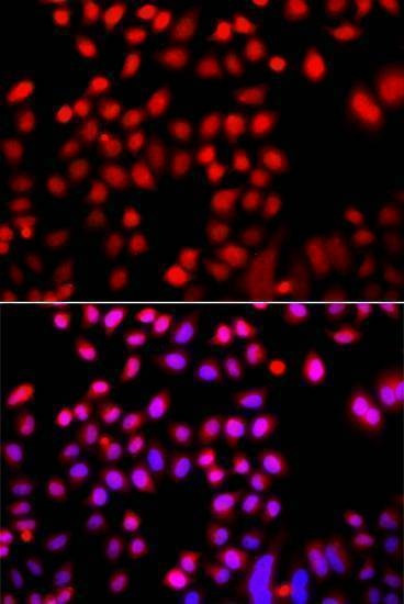 Anti-CFL2 Antibody