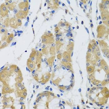 Anti-STK4 Antibody