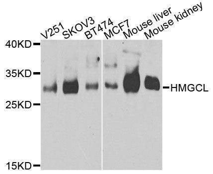 Anti-HMGCL Antibody