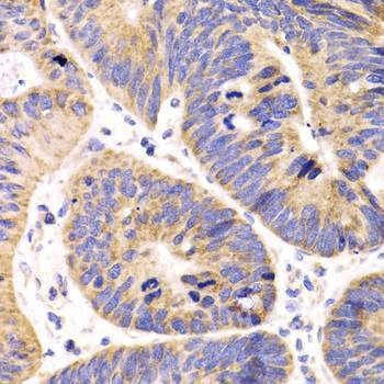 Anti-HMGCL Antibody
