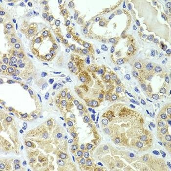 Anti-HMGCL Antibody