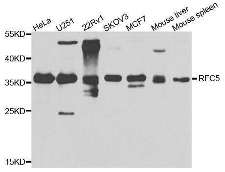 Anti-RFC5 Antibody