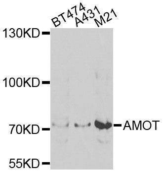 Anti-AMOT Antibody