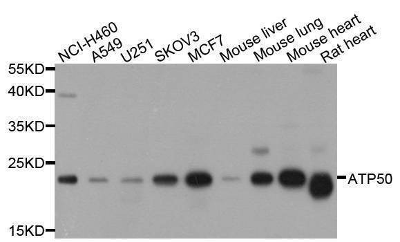 Anti-ATP5O Antibody