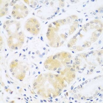 Anti-C5 Antibody