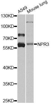 Anti-NPR3 Antibody