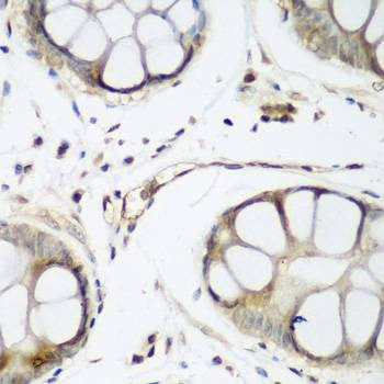 Anti-WWTR1 Antibody