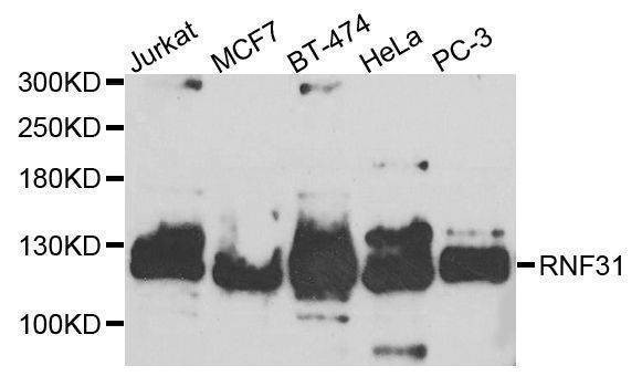 Anti-RNF31 Antibody