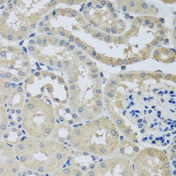 Anti-CHMP1B Antibody