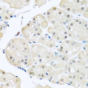 Anti-DNAL1 Antibody