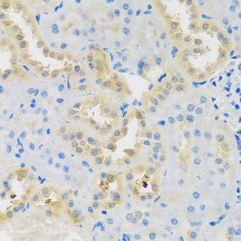 Anti-DNAL1 Antibody