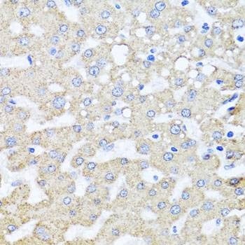 Anti-ARL6 Antibody
