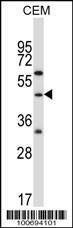 Anti-CBLC (N-term) Antibody
