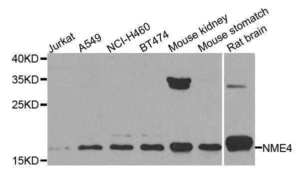 Anti-NME4 Antibody