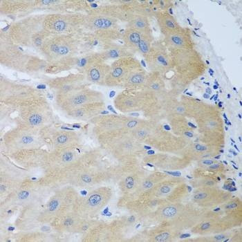 Anti-NME4 Antibody