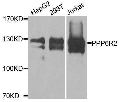 Anti-PPP6R2 Antibody