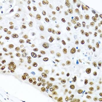 Anti-METTL3 Antibody