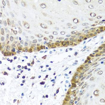 Anti-BMP5 Antibody