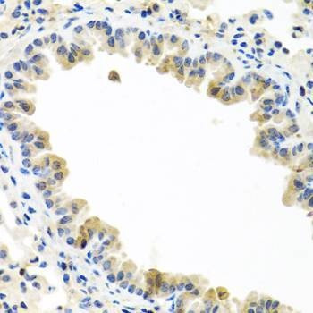 Anti-BMP5 Antibody