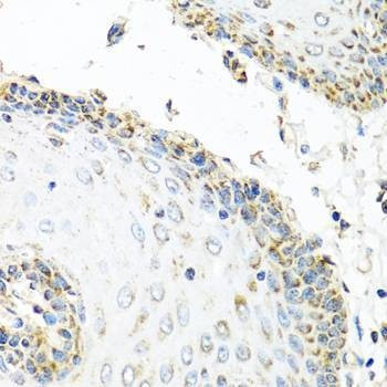 Anti-GNRH2 Antibody