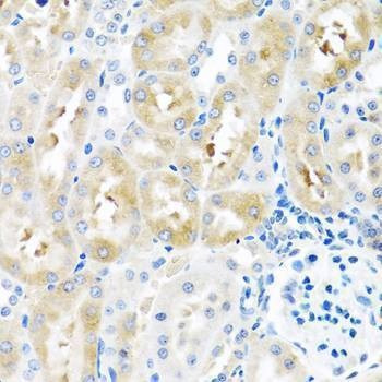 Anti-GNRH2 Antibody