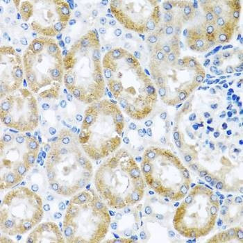 Anti-GNRH2 Antibody
