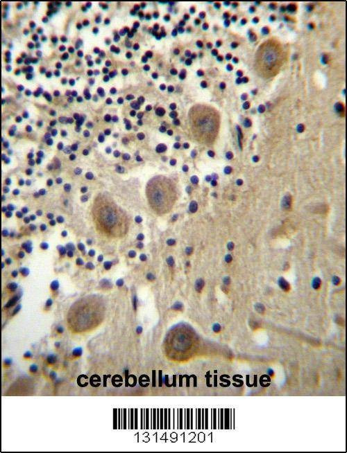 Anti-BEND6 (C-term) Antibody