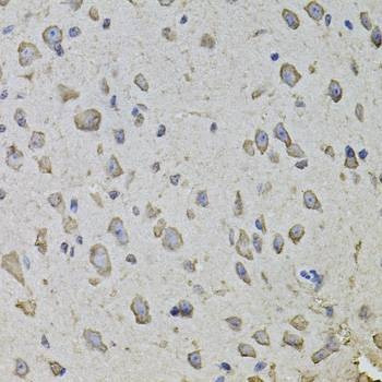 Anti-ARHGEF3 Antibody