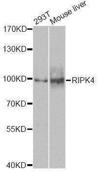 Anti-RIPK4 Antibody