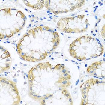 Anti-PCDHA12 Antibody