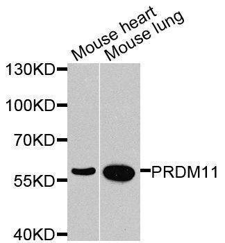 Anti-PRDM11 Antibody
