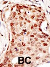 Anti-CBLC (C-term) Antibody