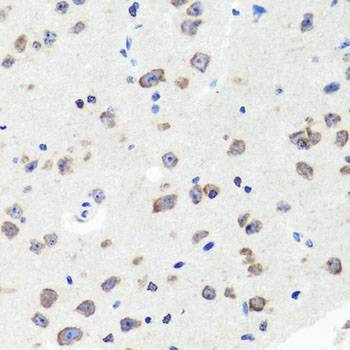 Anti-DLG1 Antibody